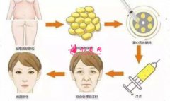 自體脂肪面部填充術(shù)前準(zhǔn)備以及手術(shù)費(fèi)用~
