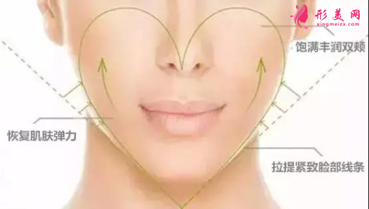 自體脂肪填充面部效果可以保持多久