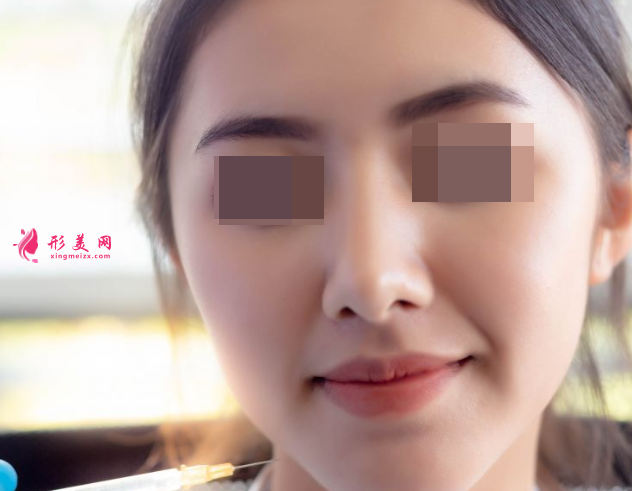 自體脂肪填充面部效果可以保持多久