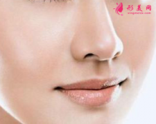 自體軟骨隆鼻術(shù)后效果好不好？