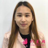 四川友誼醫(yī)院做的V-Line顏面輪廓整形90天恢復日記