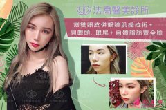 長沙美之峰謝燦雙眼皮案例在這，看不看隨你了~