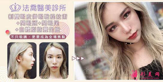 長沙美之峰謝燦雙眼皮案例在這，看不看隨你了~