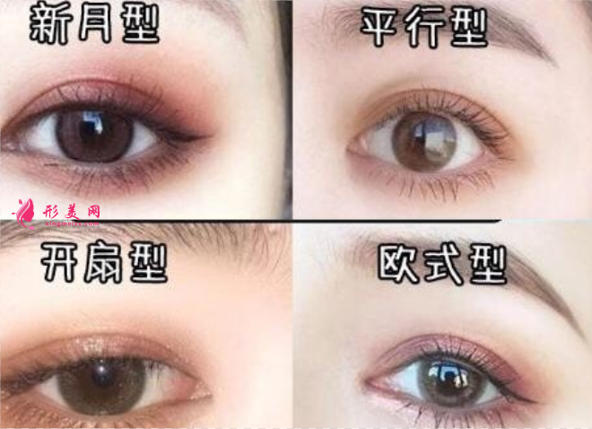 做雙眼皮的形狀有多少種