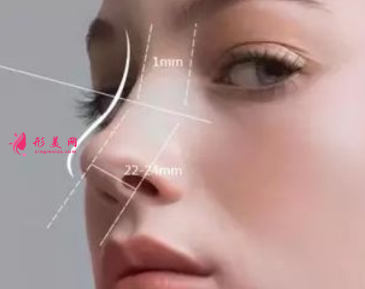 自體軟骨隆鼻會有危害嗎
