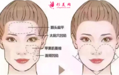 自體脂肪填充臉部恢復(fù)時間長不長？