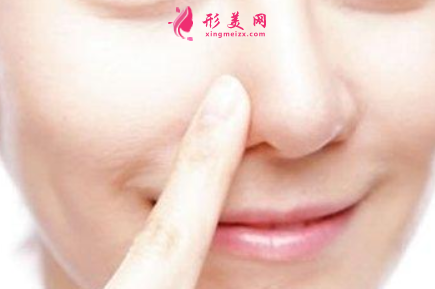 肋軟骨隆鼻效果能管多久
