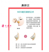 朝天鼻如何矯正？【注意事項(xiàng)】附上真人效果案