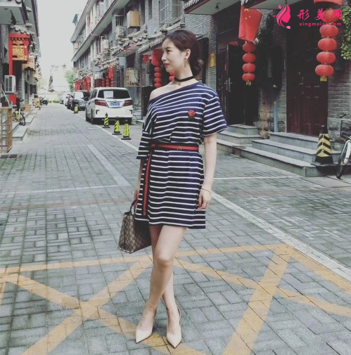 瘦臉針效果好不好？看我的術(shù)后恢復(fù)吧~