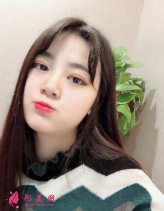 瘦臉針有效嗎？看我術(shù)后恢復(fù)效果怎么樣！