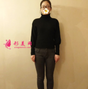 北京禾美嘉整形醫(yī)院大腿吸脂術(shù)后穿啥都漂亮 美腿上線了