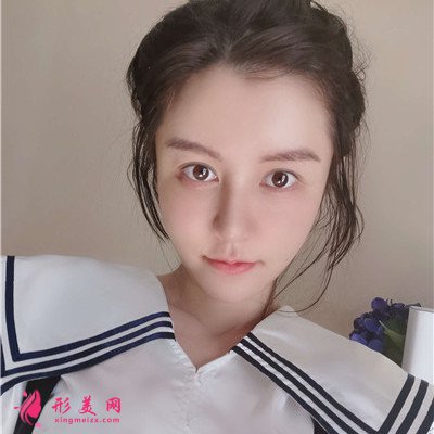 上海鼻修復(fù)術(shù)后恢復(fù)案例反饋