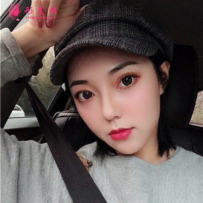 杭州面部線雕提升術(shù)后案例分享 術(shù)后 杭州面部線雕提升術(shù)后案例分享