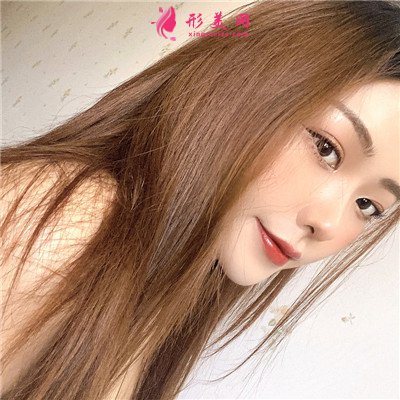 武漢耳軟骨隆鼻術后恢復情況分享 術后 武漢耳軟骨隆鼻術后恢復情況分享