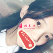廣州曙光醫(yī)學(xué)美容醫(yī)院假體隆鼻案例心得分享 比原生鼻還自然