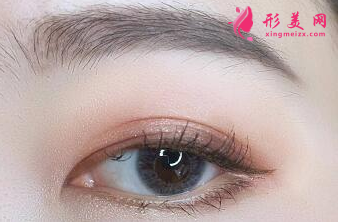 眼角開大了還能修復(fù)嗎