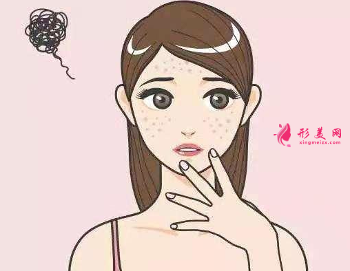 如何改善臉上的色斑