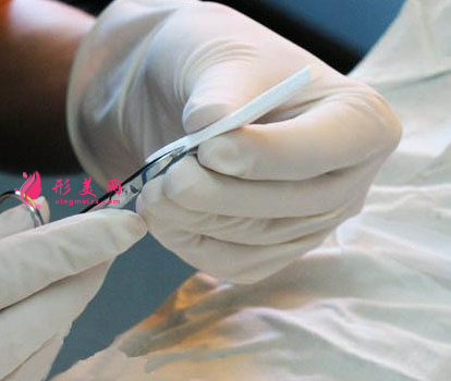 膨體隆鼻手術多少錢