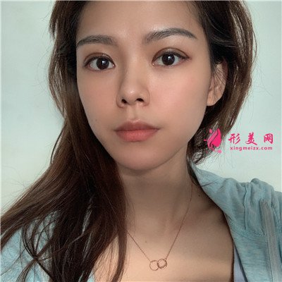 b87a532ab660-audio.jpg