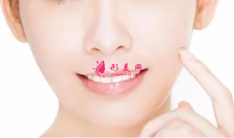 激光祛斑費(fèi)用價(jià)格是多少