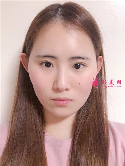 b54b4bd395c6-audio.jpg