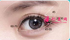 開(kāi)眼角失敗了多久可以修復(fù)