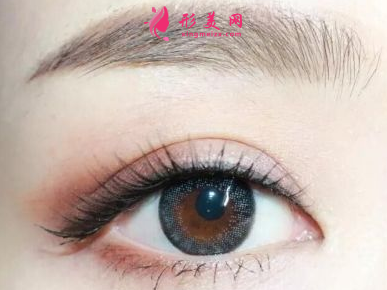 開(kāi)眼角失敗修復(fù)多少錢(qián)