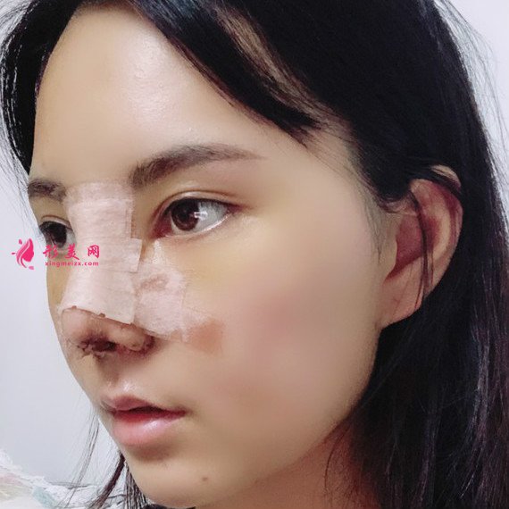 女人無需傾國傾城的整形術(shù)后圖片