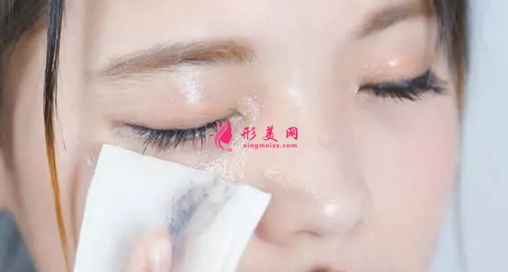 祛眼袋手術(shù)失敗會(huì)出現(xiàn)什么問(wèn)題