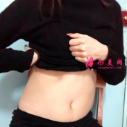 四川友誼醫(yī)院整形科腰腹吸脂案例、肚子很平坦，穿啥都好看