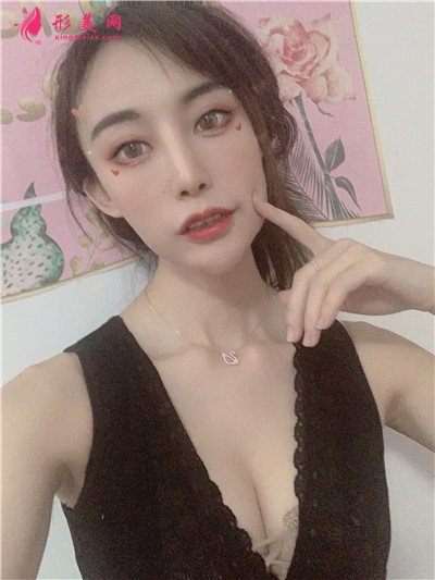 重慶小姐姐自體脂肪隆胸案例分享 術(shù)后 重慶小姐姐自體脂肪隆胸案例分享