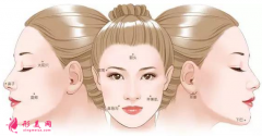 自體脂肪填充面部的風(fēng)險是什么？