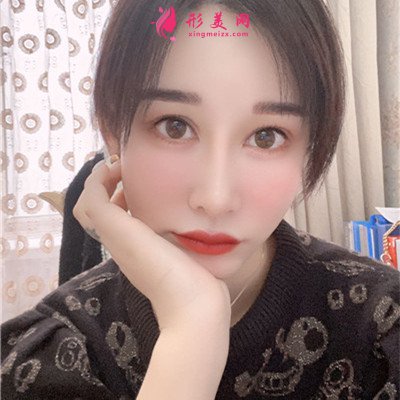 成都眼部修復(fù)手術(shù)術(shù)后效果展示