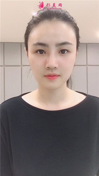 56ef1c5b6324-audio.jpg