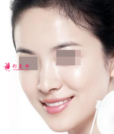 做彩光嫩膚效果如何