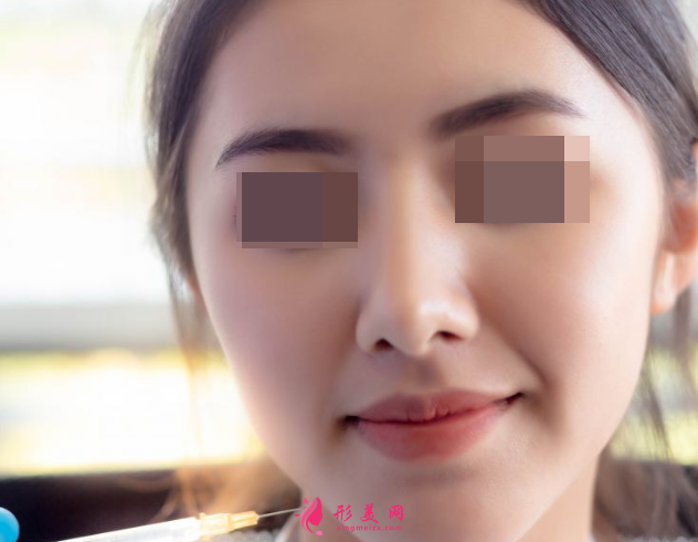 自體脂肪填充臉部什么時(shí)候消腫