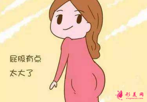 臀部吸脂可以減掉多少脂肪