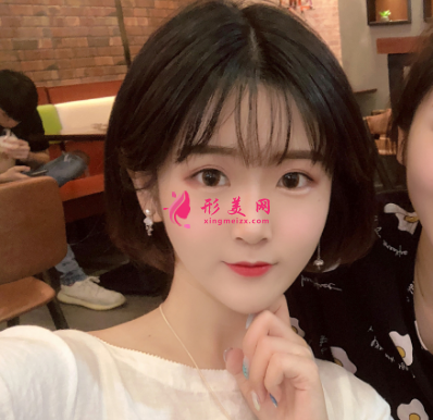 水氧活膚的效果怎么樣呢？案例分享術(shù)后60天前后對(duì)比圖
