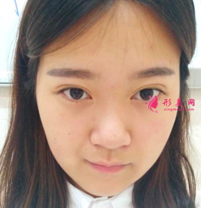 鄭州締萊美醫(yī)療美容醫(yī)院鼻部多項案例