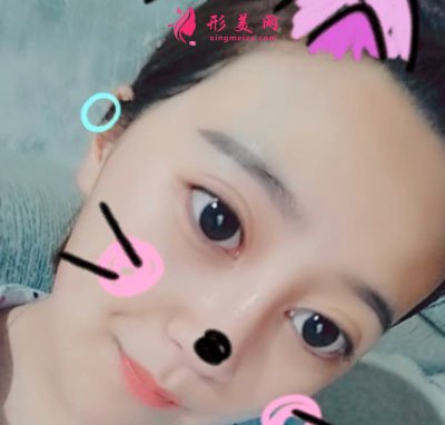 鄭州締萊美醫(yī)療美容醫(yī)院鼻部多項案例