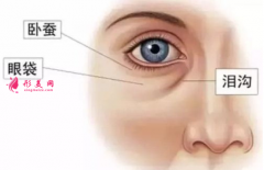 年輕人為什么會有眼袋？