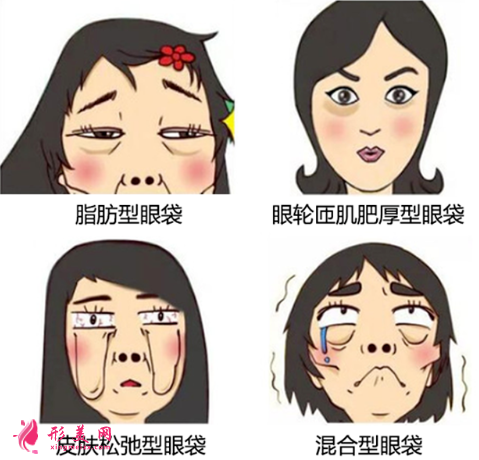 內(nèi)切祛眼袋和外切祛眼袋有什么區(qū)別