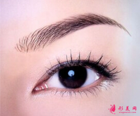 開(kāi)眼角要注意的風(fēng)險(xiǎn)問(wèn)題