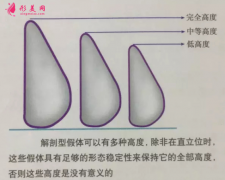 假體隆胸后吃什么比較好？