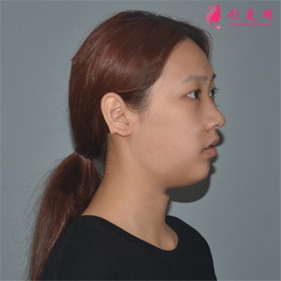 b28060642411-half.jpg