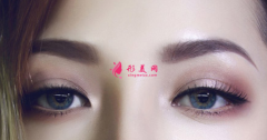 埋線雙眼皮怎么快速恢復？
