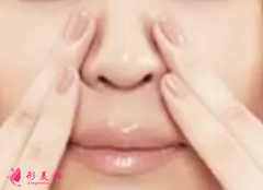 鼻翼縮小手術(shù)前要注意什么?