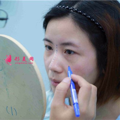 鄭州鼻綜合手術(shù)術(shù)后恢復情況分享