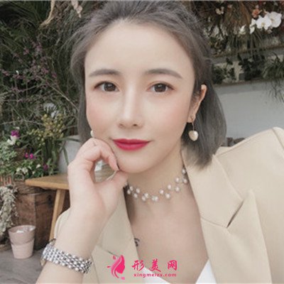 鄭州鼻綜合手術(shù)術(shù)后恢復情況分享 術(shù)后 鄭州鼻綜合手術(shù)術(shù)后恢復情況分享