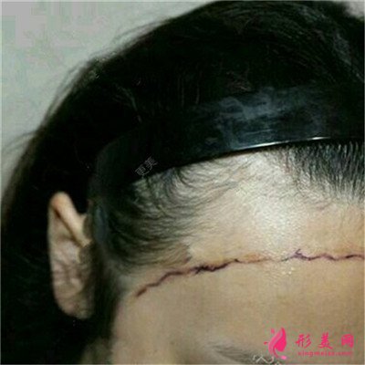 72c98c60a3c7-half.jpg